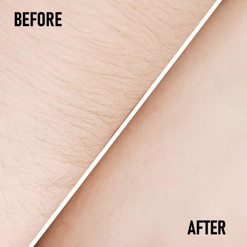 PHOFAY Pain-Free Hair Removal Cream – Gentle & Effective Depilatory for Smooth Skin