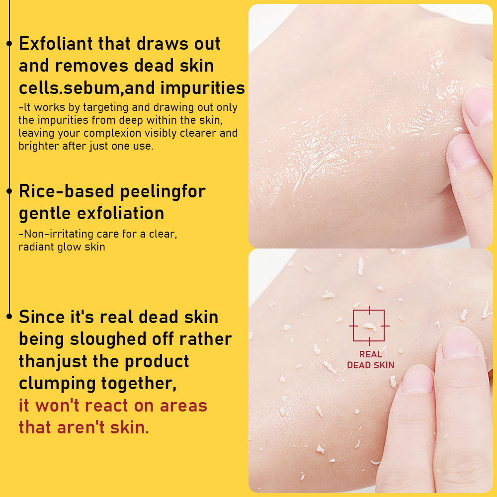 PHOFAY Exfoliating Set – Deep Cleansing Body & Face Scrub Kit for Smooth, Radiant Skin